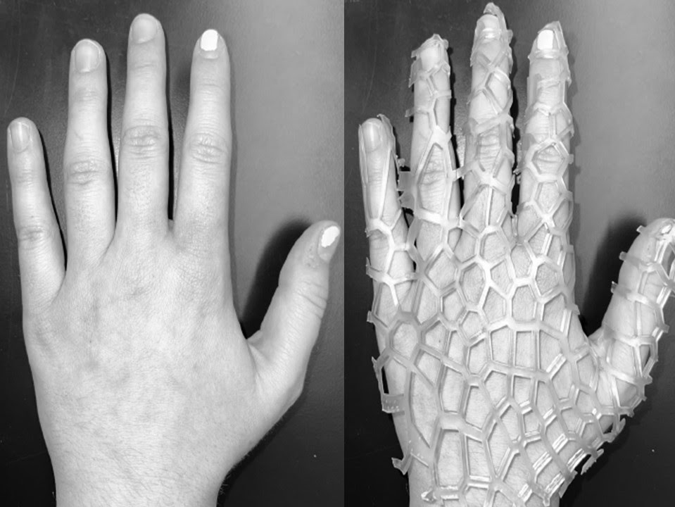 3d printed form perfectly fit to a hand